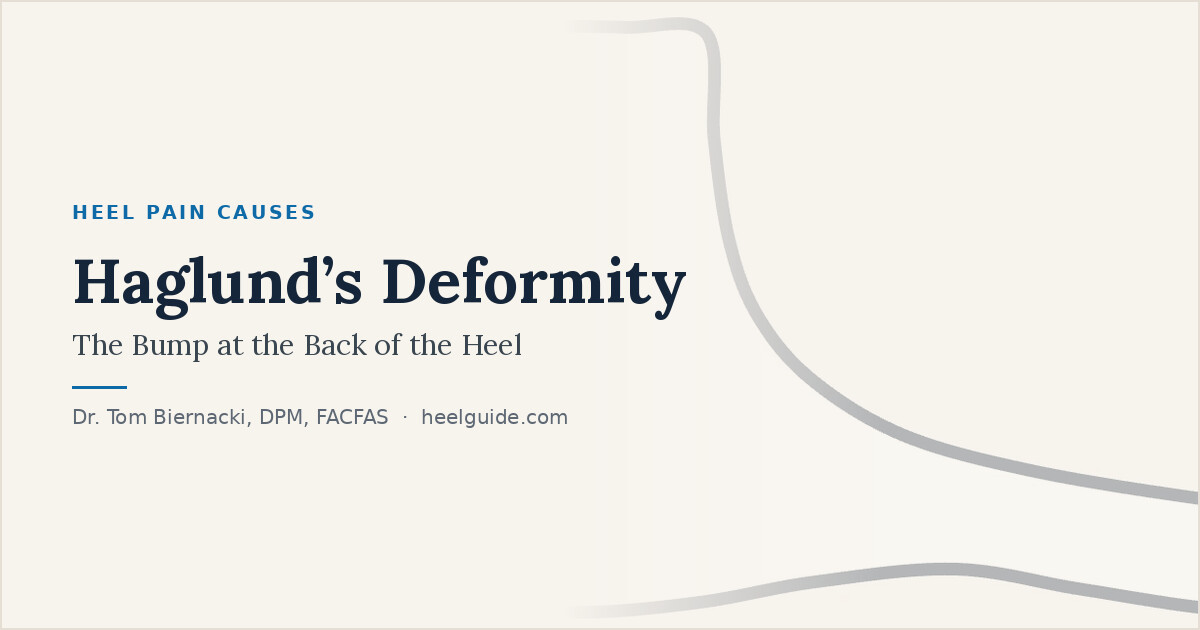 Heel Guide share card: Haglund’s Deformity: The Bump at the Back of the Heel