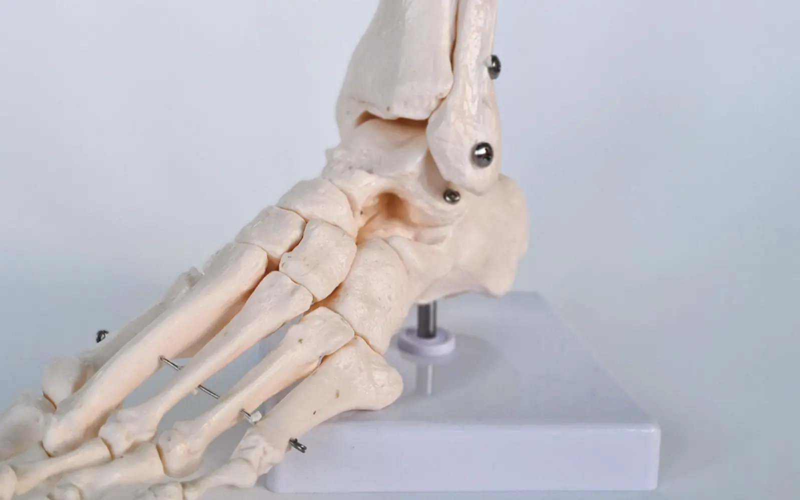 A skeletal model of the foot and ankle, showing the heel bone and joints that most heel pain involves.