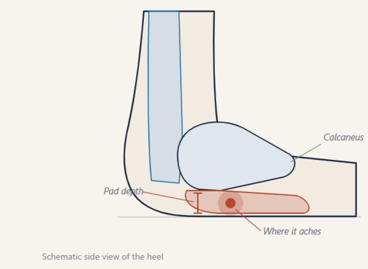 Schematic side view of the heel showing the fat pad beneath the heel bone with its depth marked, and the mid-underside area where a thinned pad aches.