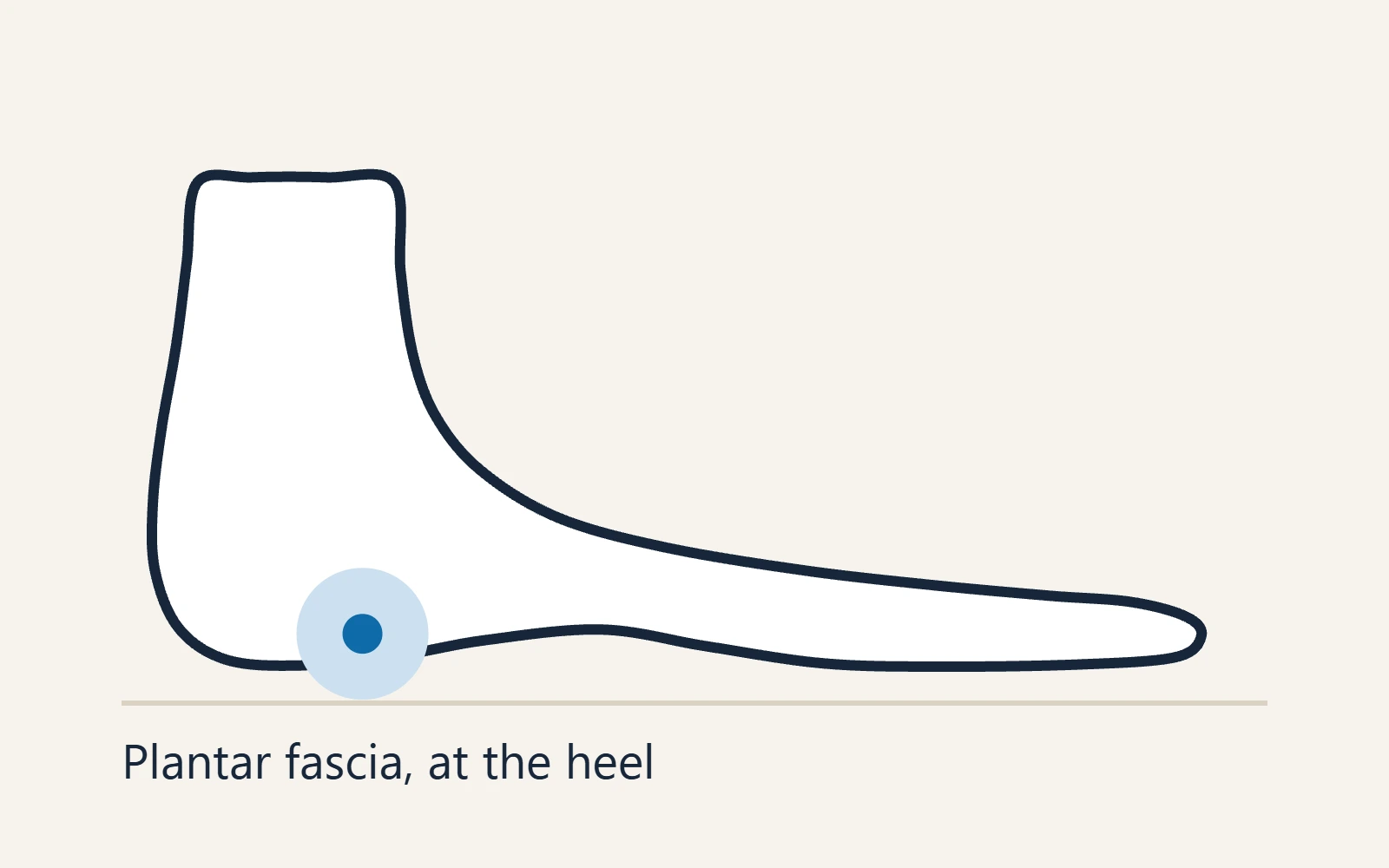 Side view of the heel marking where the plantar fascia attaches to the heel bone.
