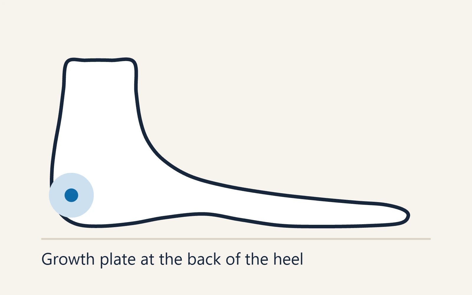 Side view of a child's heel marking the growth plate at the back of the heel bone