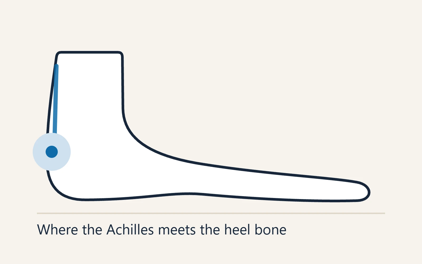 Schematic side view of the foot: Where the Achilles meets the heel bone