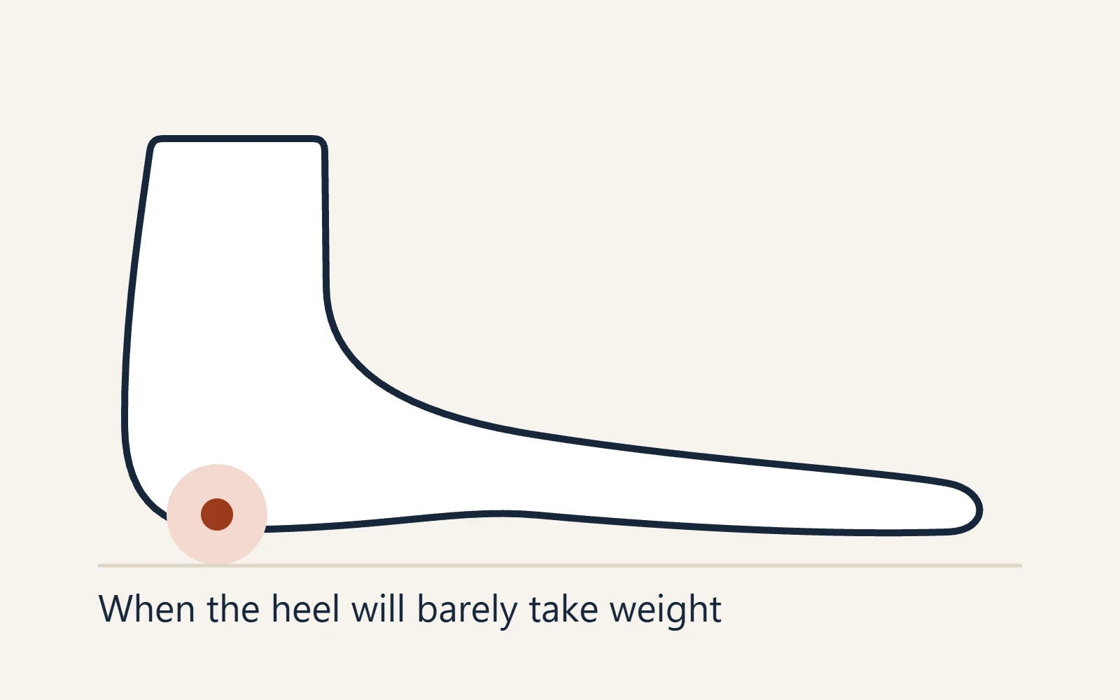 Schematic side view of the foot: When the heel will barely take weight