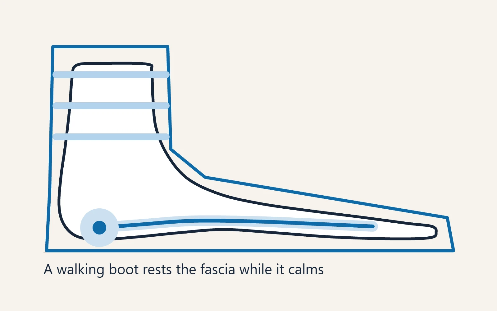 Foot diagram inside the outline of a tall walking boot used to rest the plantar fascia